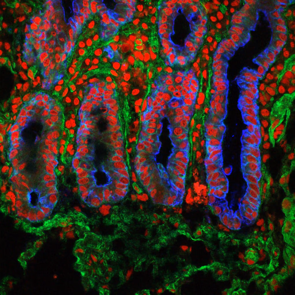 Improve Gut Health